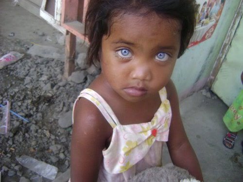 black baby girl with blue eyes