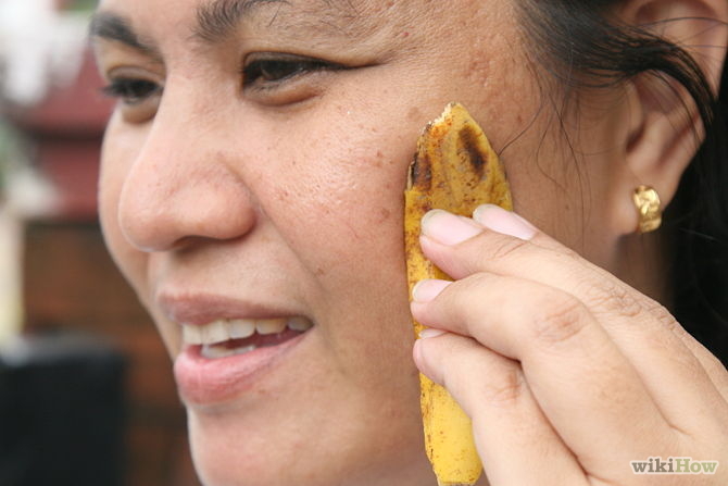 soigner l'acné avec la peau de banane -Use-Banana-Peels