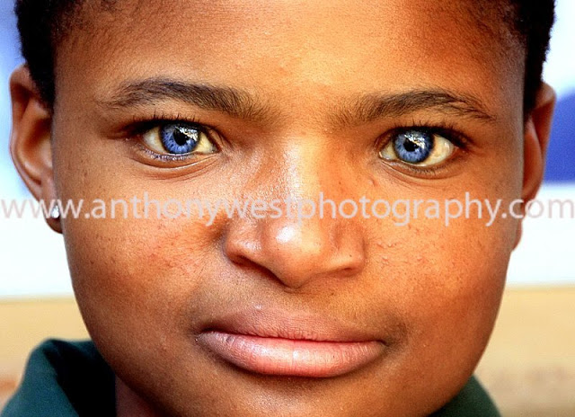 african deaf blue eyes