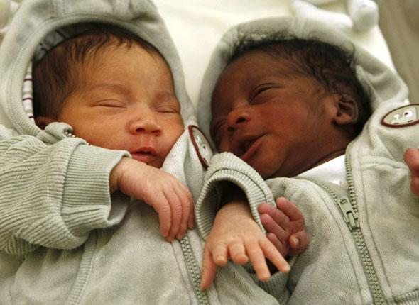 Twins With Different Skin Colour One Black One White Twins Afroculture Net