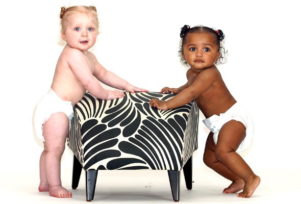 Twins With Different Skin Colour One Black One White Twins Afroculture Net