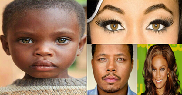 Different kinds of hazel eyes
