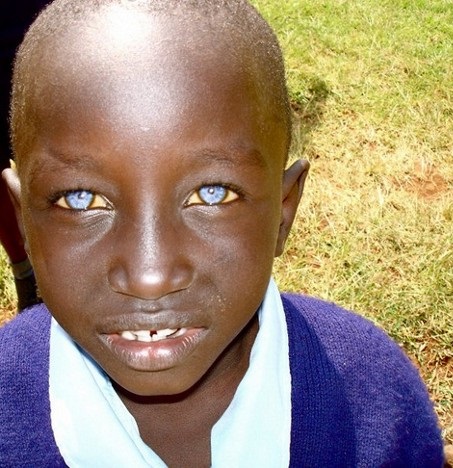 Blacks With Blue Eyes : Origin, Myth And Everything You Need To