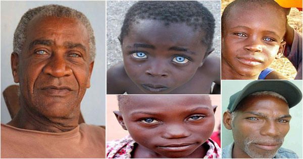 Black People With Blue Eyes