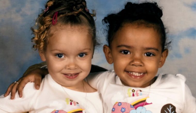 Twins With Different Skin Colors Marcia And Millie Biggs 9338