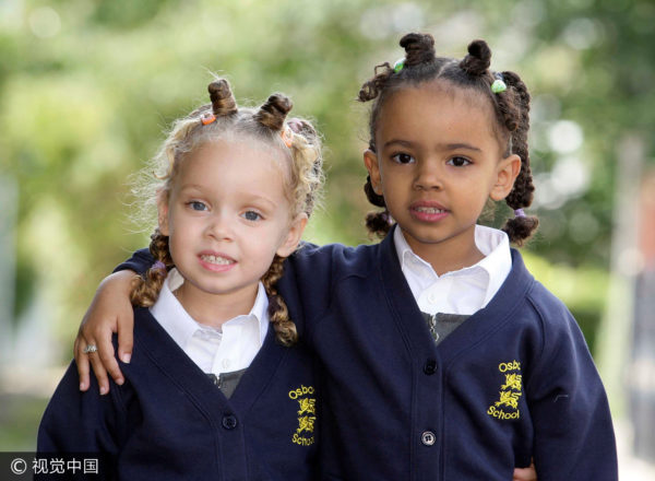 Twins With Different Skin Colors Marcia And Millie Biggs 1741