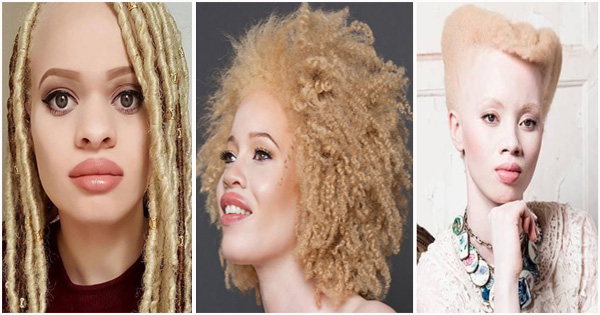 9 hairstyles ideas for albino women 